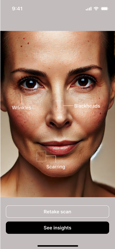 AI Skin Analysis